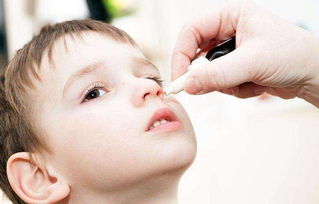 婴儿怎么预防过敏性鼻炎